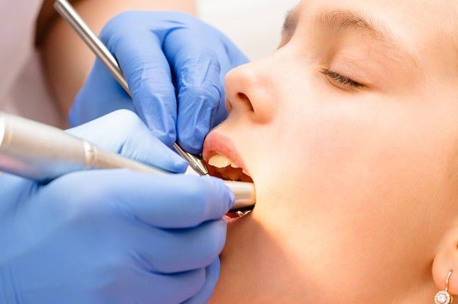 Cavity Treatment & Prevention